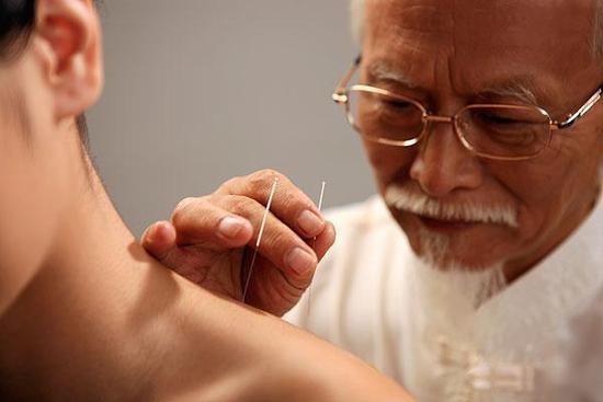 Acupuncture: