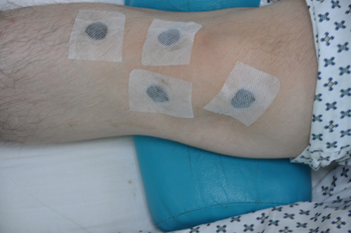 Acupoint paste